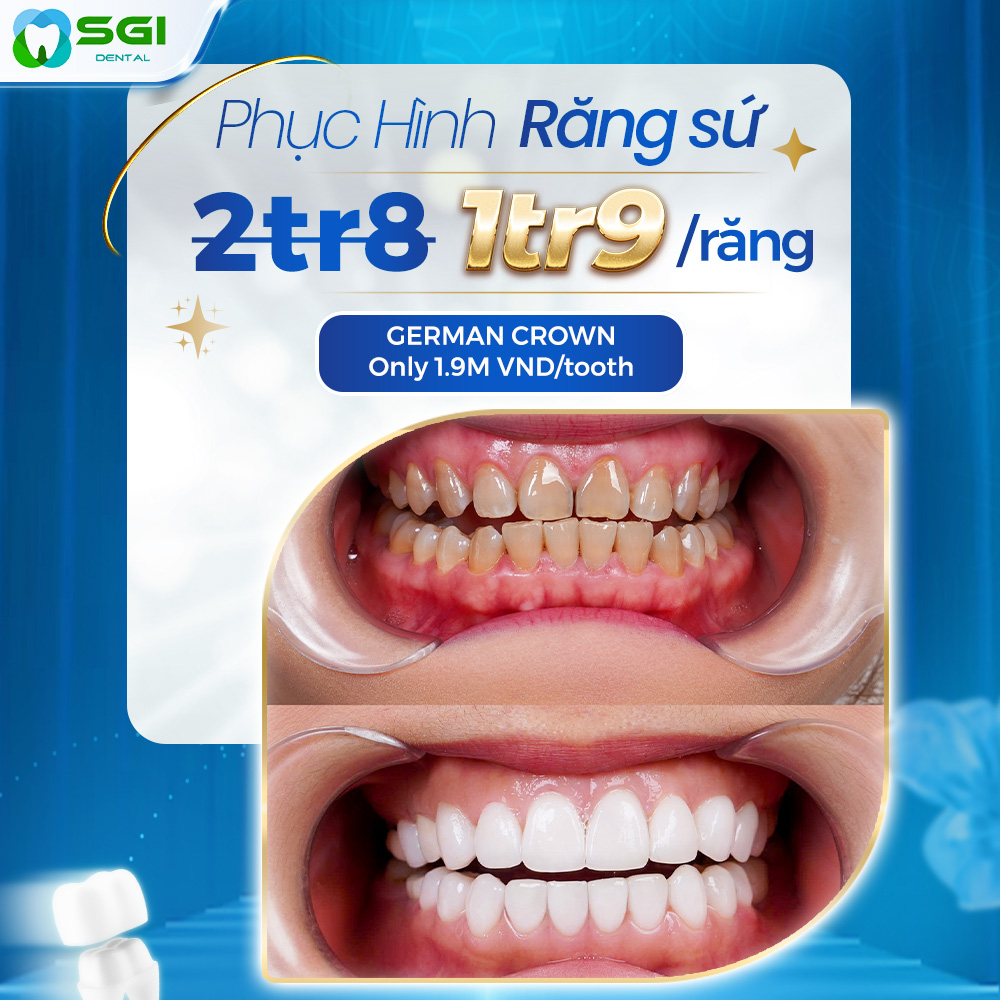 CƯỜI SANG THỜI THƯỢNG – THẮNG ĐỜI LÊN HƯƠNG! ✨CHỈ TỪ 1TR9 CÓ NGAY NỤ CƯỜI THẨM MỸ - ĂN NGON TRỌN ĐỜI